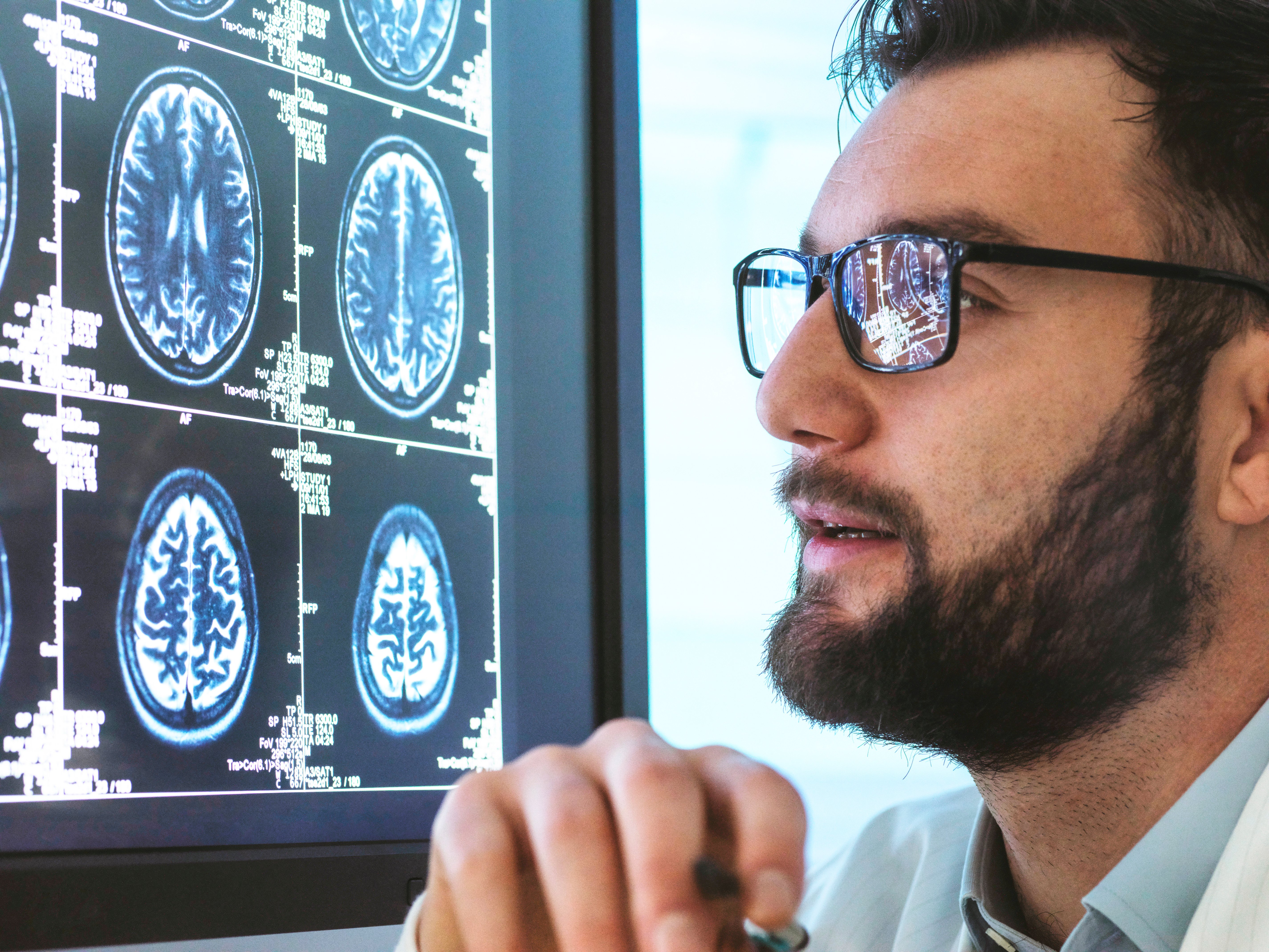 Doctor examines brain scans